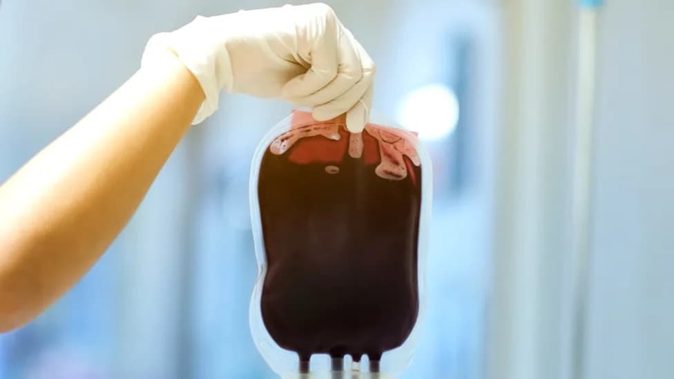 Can Alzheimer’s Pathology Be Transmitted by Blood Transfusion? What a New Lancet Review Says