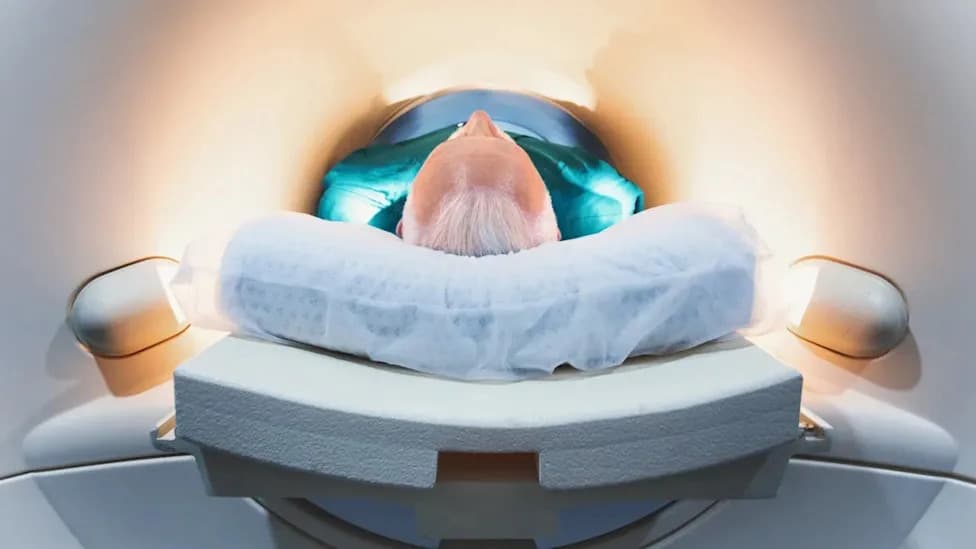 Midlife Immune Shift in the Brain Around Age 50 May Raise Dementia Risk