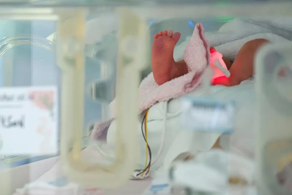 Newborn at Center of Texas Surrogacy Dispute Is Critically Ill After Norwood Heart Surgery