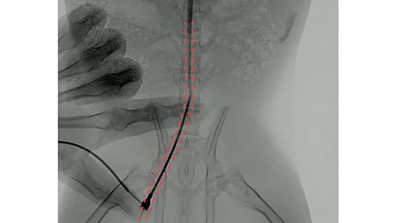 CiliaVine: Microscopic Soft Robot That Steers Drugs, Breaks Clots and Captures Cancer Cells