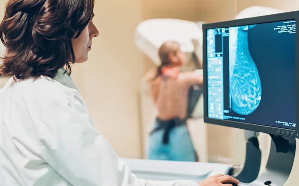 Mammograms May Also Detect Heart Disease and Past Strokes, AI Study Finds