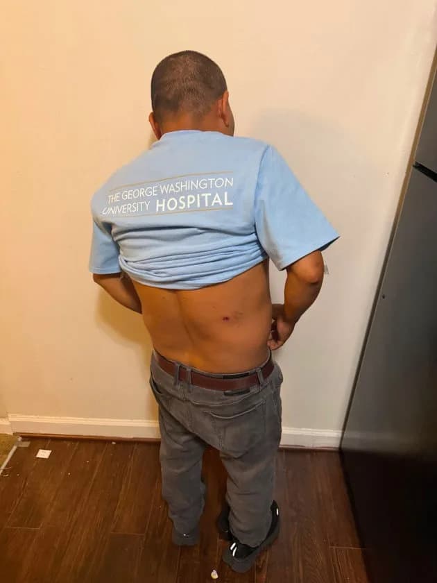 Man Files Police Report Alleging He Was Beaten By ICE Officers; Lawyers Demand Criminal Probe