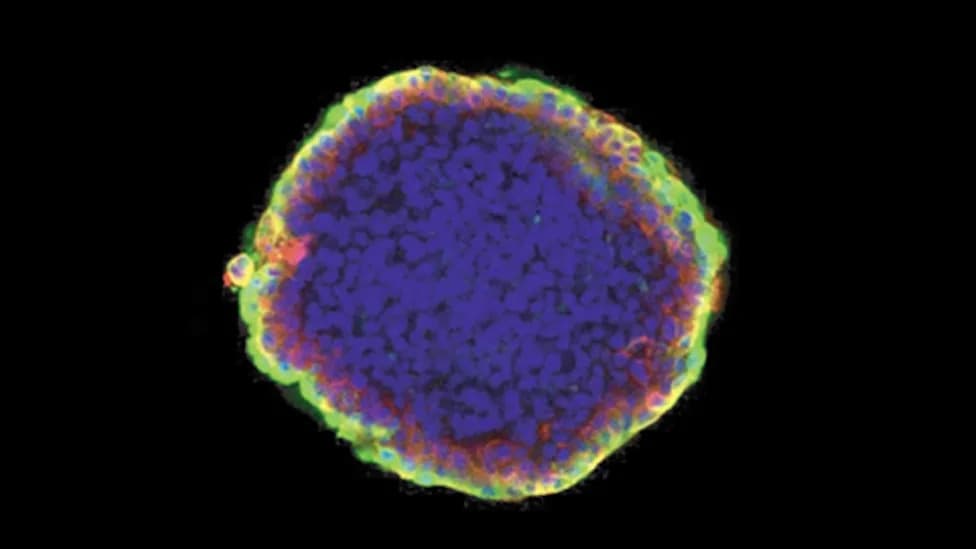 Short THC Pulse May Lock Breast Cancer Cells Into a Less Aggressive State — CB2 Receptor Identified
