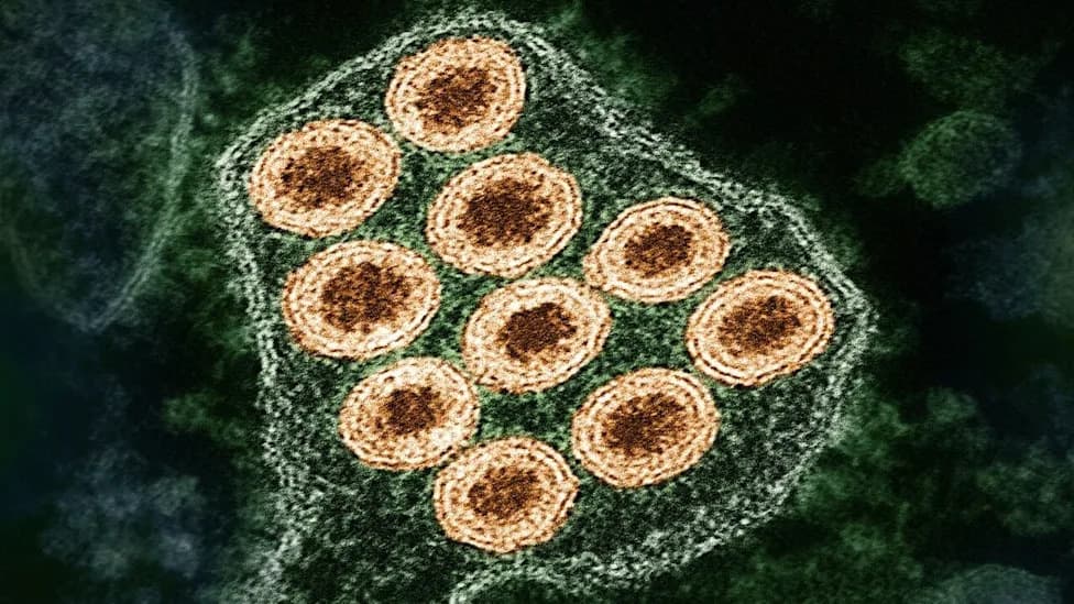 Study Suggests US May Miss Over 90% Of Human Rabies Cases — Organ-Donor Discoveries Raise Alarm
