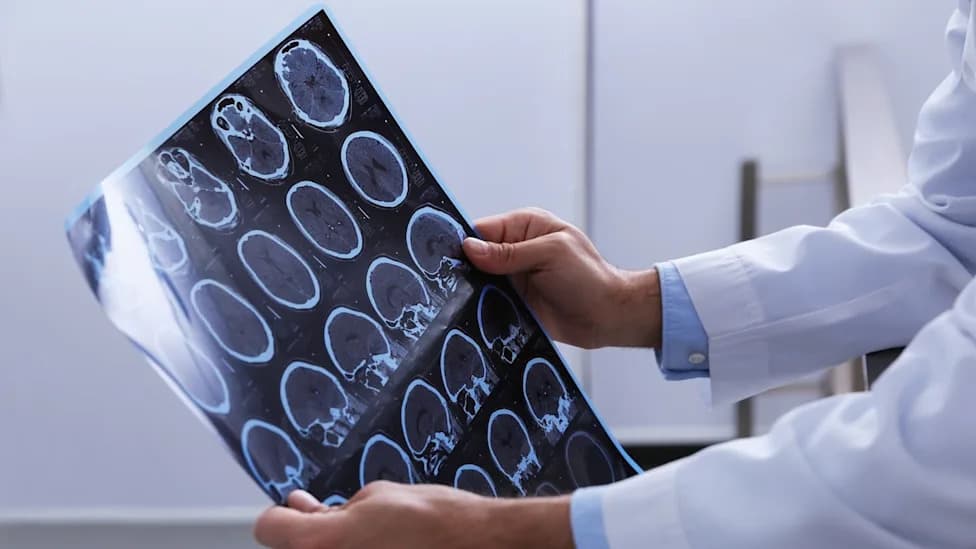 Novartis’ Oral BTK Inhibitor Remibrutinib Meets Primary Endpoints in Phase III REMODEL Trials for Relapsing MS
