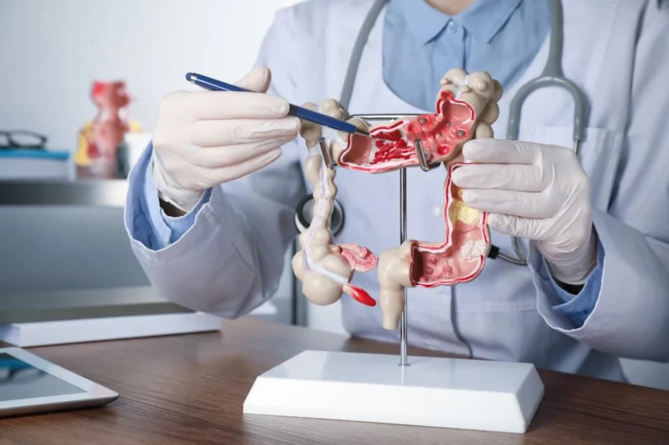 Major Study Shows Biological Differences in Bowel Cancer Diagnosed Before Age 50