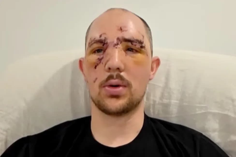 Hunter Films Goodbye After Bear Mauling — Cousin’s Gunfire and Medical Aid Save His Life