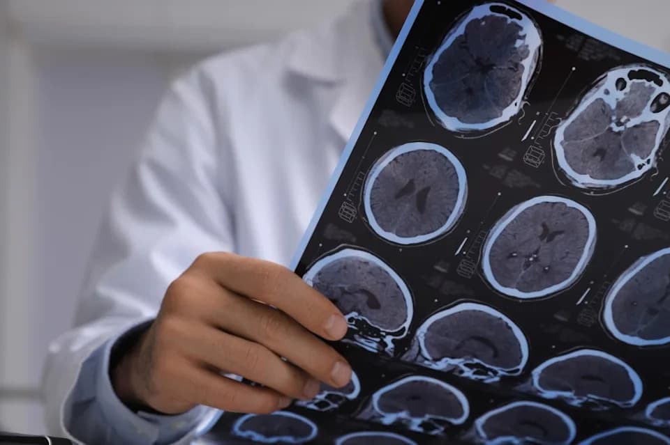 MRI Detects Alzheimer’s-Linked Brain Changes At Least Seven Years Before Amyloid Shows On PET