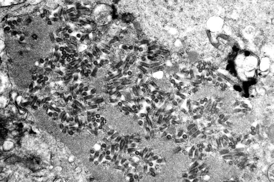 Rabies Alerts Spread Across U.S. as Local Cases Rise — Bats, Raccoons, Foxes, Goats and a Pet Dog Confirmed