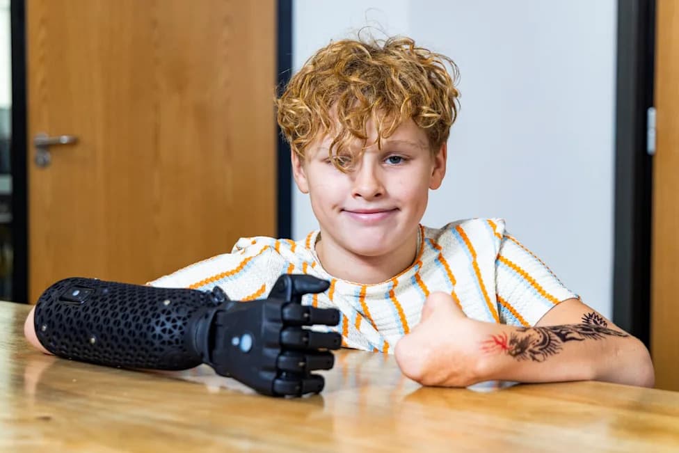 11-Year-Old Who Lost All Four Limbs Fitted With Advanced Hero PRO Bionic Arm Ahead Of Secondary School