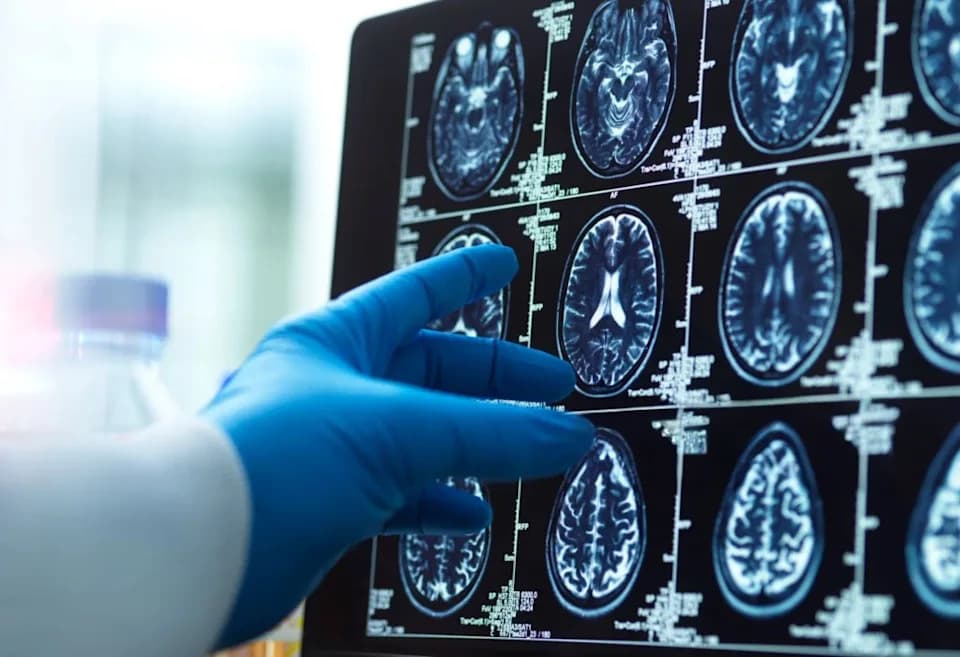 Peripheral Immune Cells May Drive Alzheimer’s‑Like Brain Damage, Mouse Study Finds