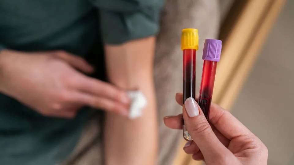 Routine Blood Tests May Reveal Clues to Early‑Onset Colorectal Cancer, New Analysis Finds