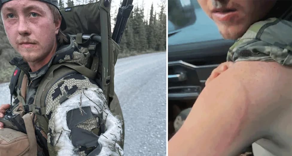 ‘I’m Glad I Blacked Out’: Moose Hunter Miraculously Escapes Brown Bear Attack Near Soldotna