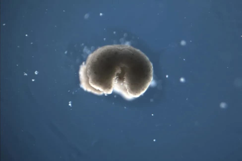 Biobots From Dead Cells: How Xenobots and Anthrobots Blur Life, Death and Medicine