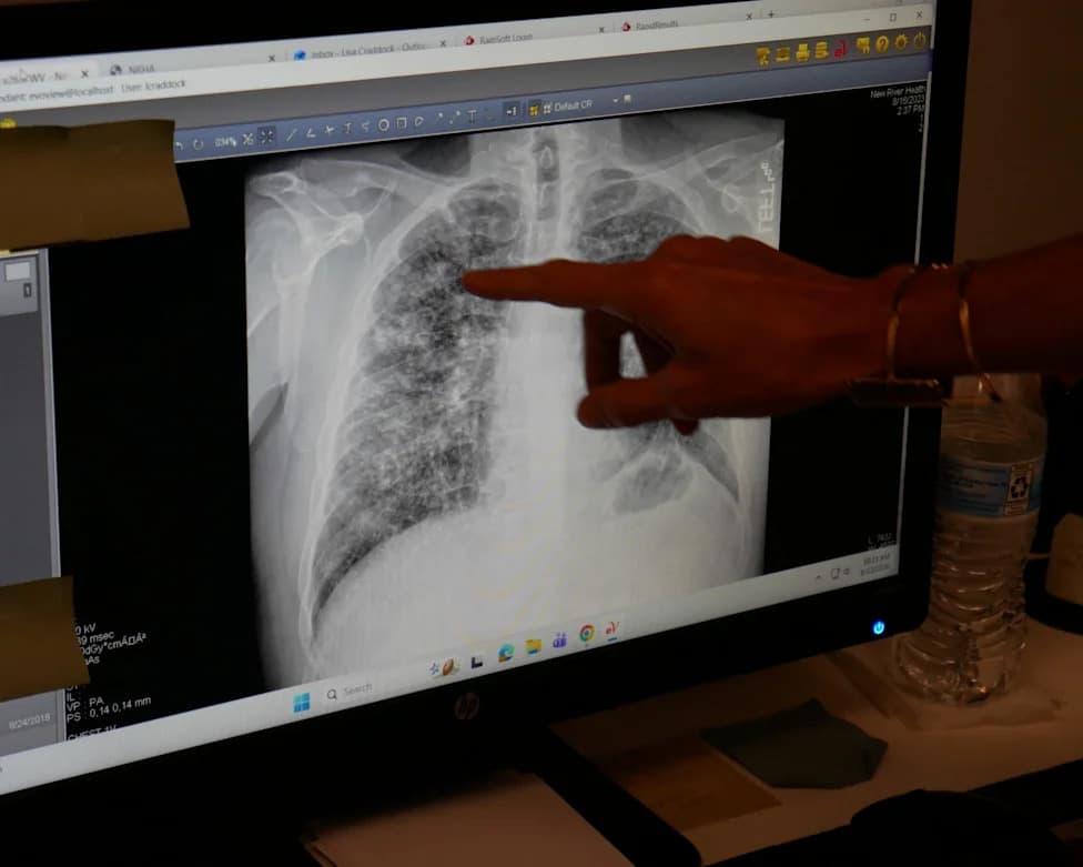 We Know How To Prevent Black Lung — So Why Are Workers Still Dying?
