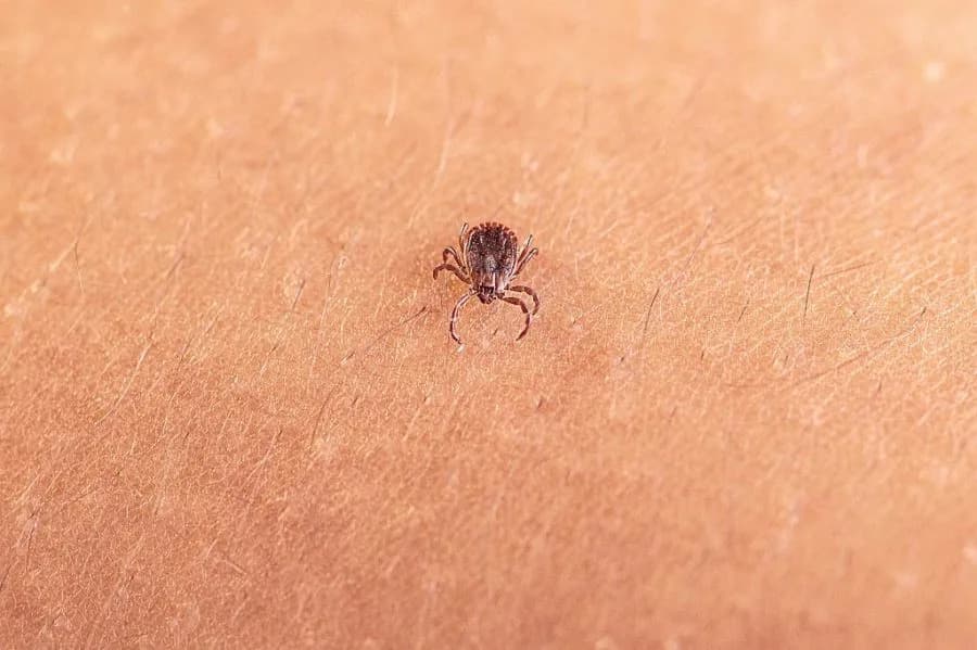 New Virus Found in Invasive Asian Longhorned Tick — What It Means for the U.S.