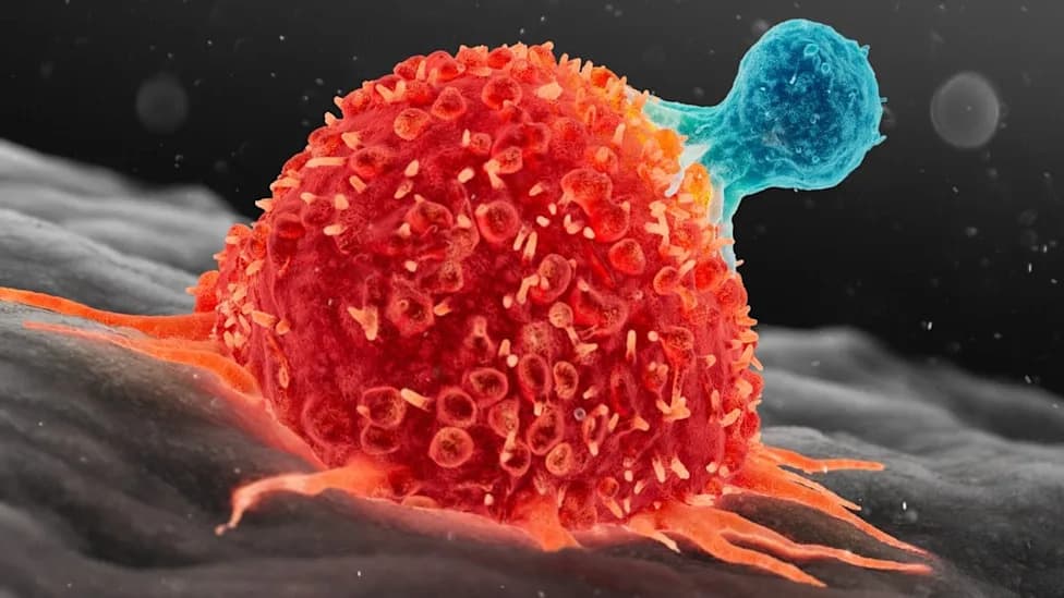 Experimental GPC3‑Targeted CAR T Therapy Clears Metastatic Liver Cancer in 3‑Year‑Old After Two Doses