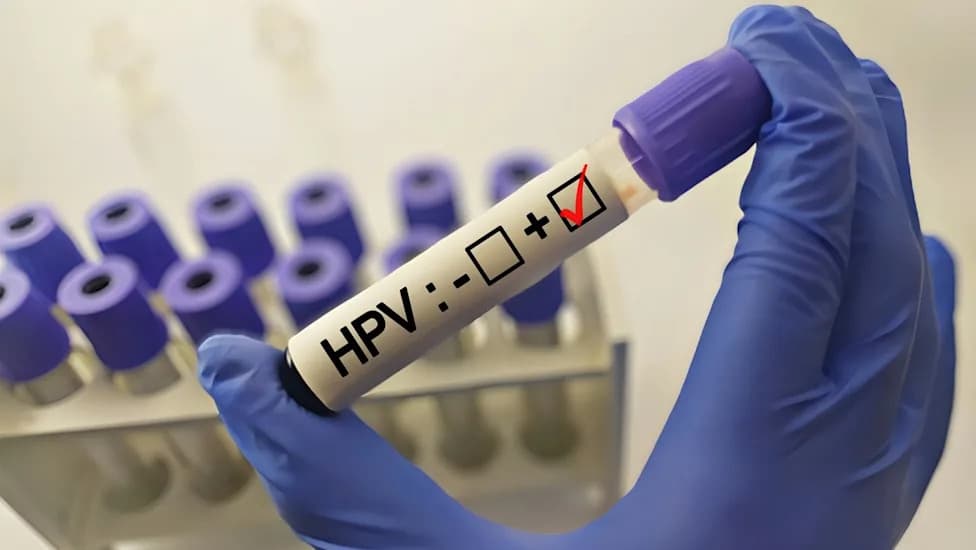 Everlywell and Waters Launch FDA‑Cleared At‑Home HPV Self‑Collection to Boost Cervical Cancer Screening