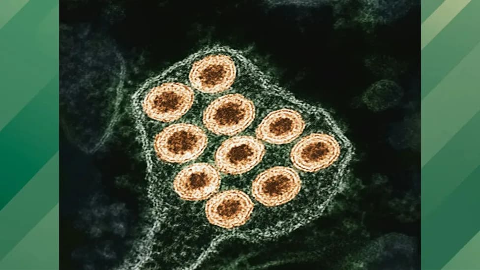 CDC Issues Health Advisory After Spike In Human Rabies Exposures — Unusual Animal Cases Reported