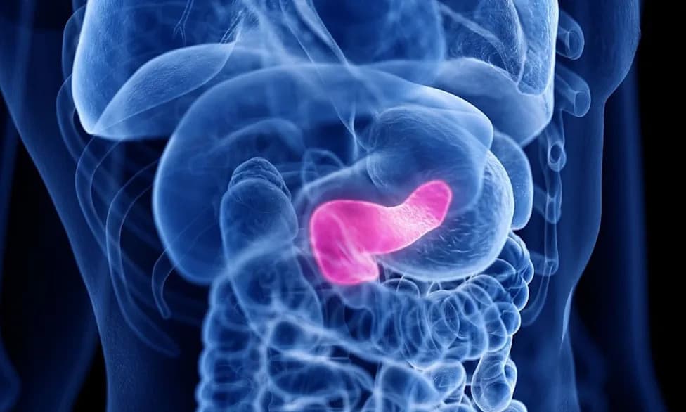 AI Blood Test PANXEON Detects Early Pancreatic Cancer With 87% Sensitivity — Promising But Investigational