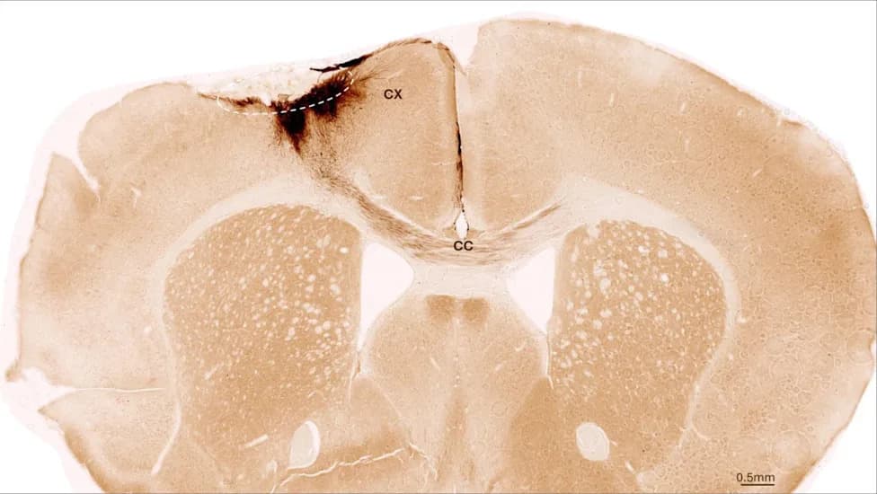Human Stem Cell Grafts Rebuild Neural Circuits and Improve Movement in Stroke-Damaged Mice
