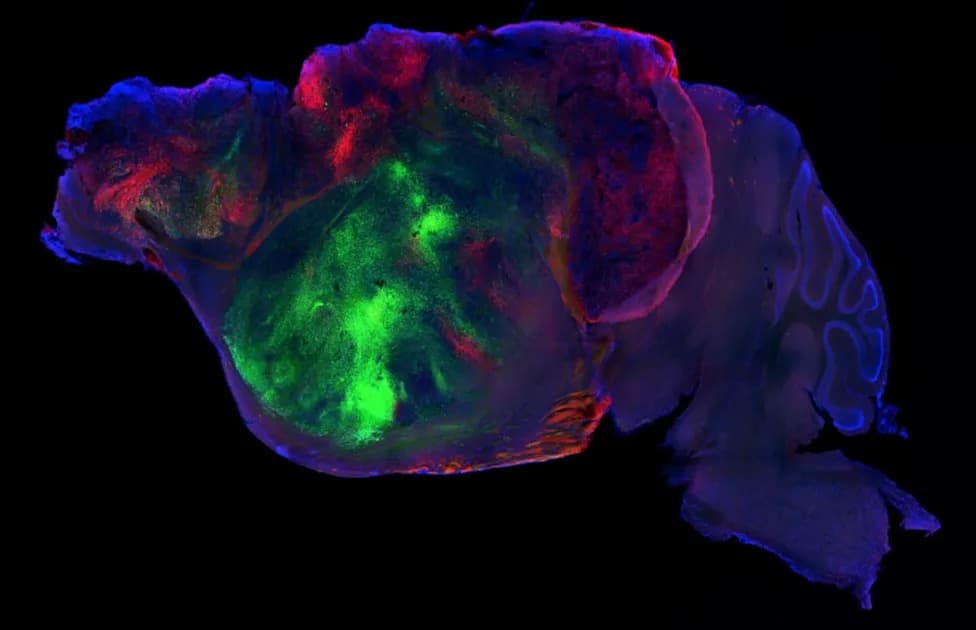 Millions of Human Neurons Grafted Into Mouse Brains Could Yield Better Models of Brain Disorders