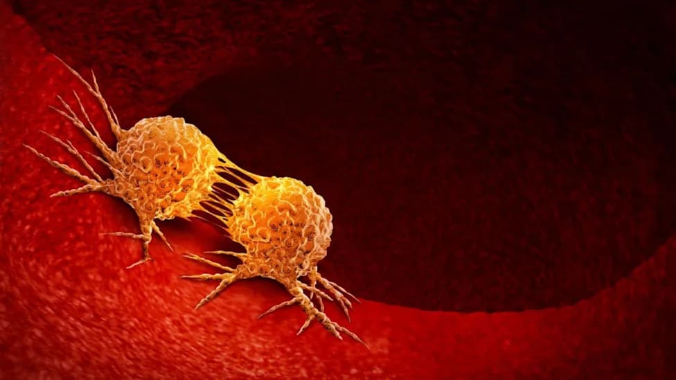 Rare Inherited EGFR T790M Mutation Tied to Dramatically Higher Lung Cancer Risk—Especially in Never-Smokers