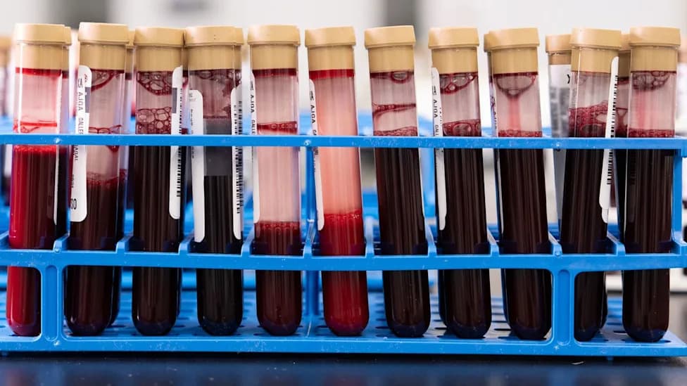 FDA Panel Endorses Galleri Blood Test That Detects Signs Of 50+ Cancers — What To Know