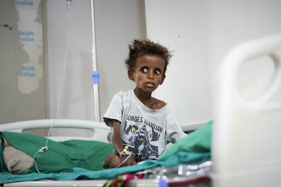 Yemen’s War Returns: Hospitals Overwhelmed as Health System Nears Collapse