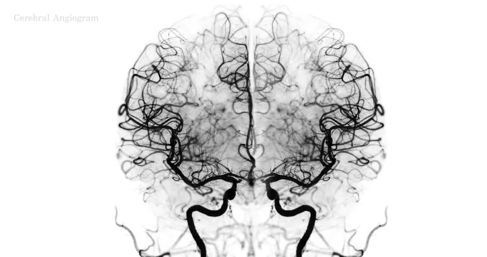 MIT Study: Brain Uses Reusable Neural 'Building Blocks' to Hold Different Kinds of Information