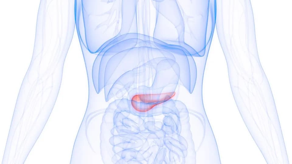 Study: Cancer Rates Rising Faster Among People With Type 2 Diabetes — Obesity-Related Cancers Drive The Trend