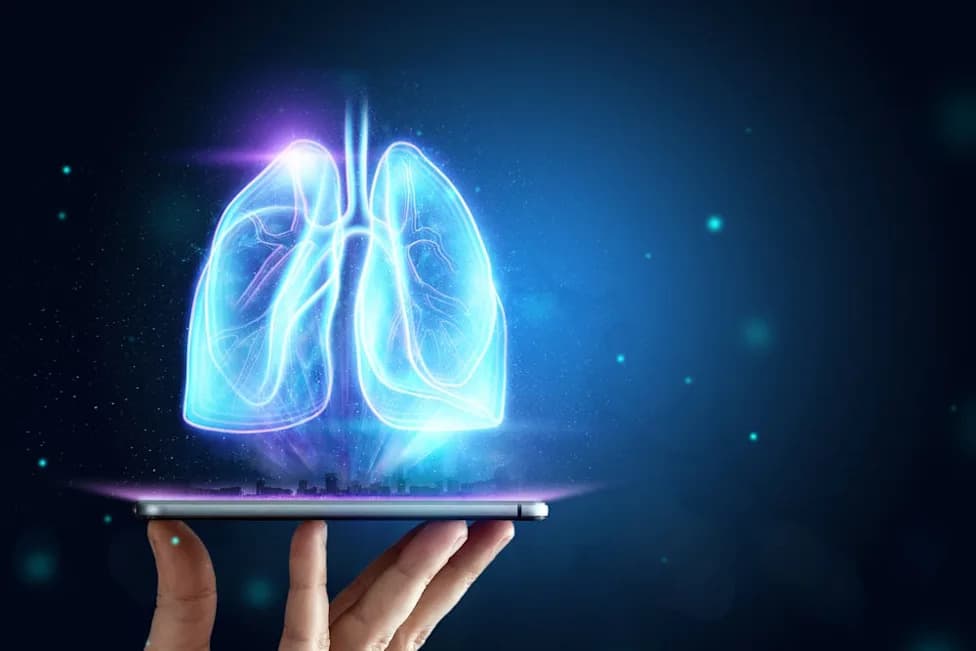 AI Imaging Breakthrough: Brainomix’s e‑Lung Predicts Progression and Detects Treatment Response in Phase III PPF Trial
