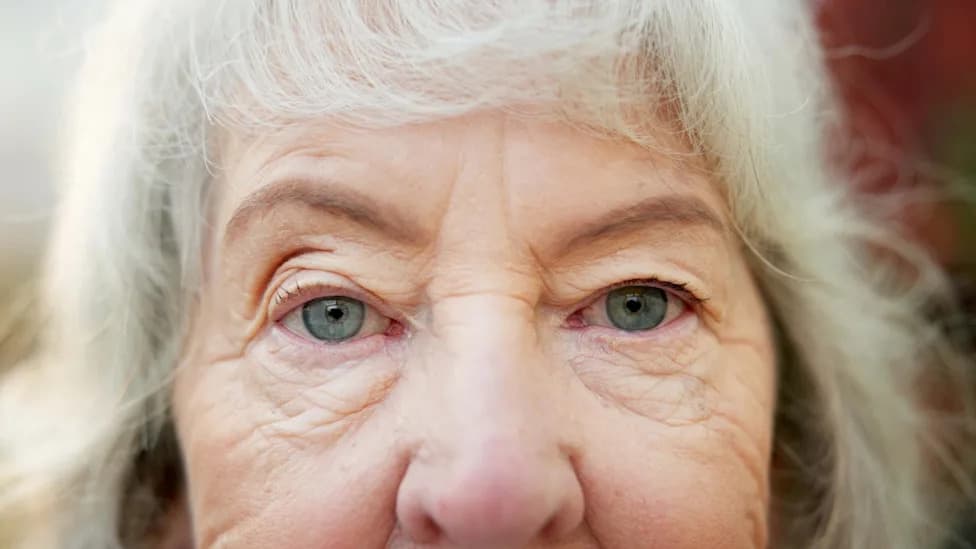 Scalpel- and Laser-Free Vision Correction? Electrical ‘Mold’ Reshapes Cornea in Lab Tests