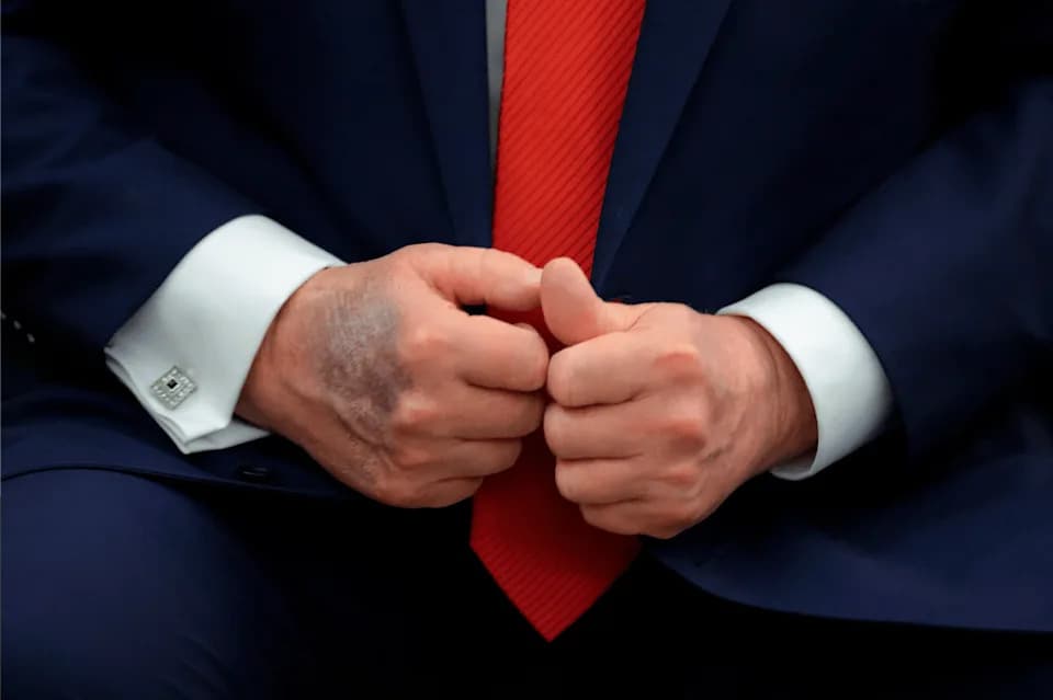 Trump Says He Takes 325 mg Aspirin Daily — Unsure If It Helps; Experts Warn Of Bleeding Risk