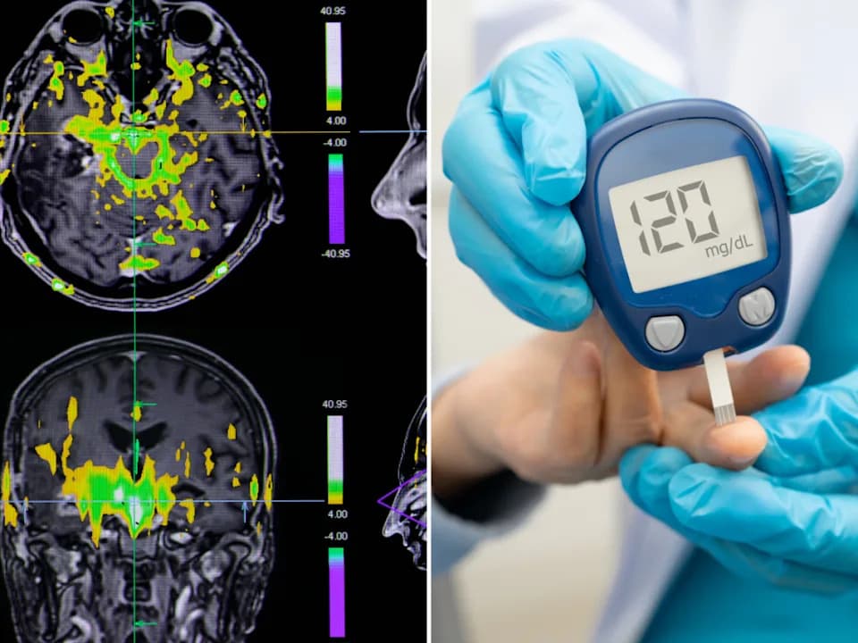 Ultra-Processed Meals Trigger Distinct Metabolic and Brain Responses, Virginia Tech Study Finds